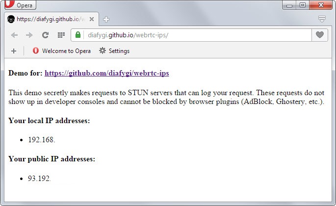 local ip address